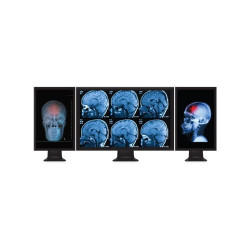 Multi Stream Transport Hub &ndash; Mini DisplayPort 1.2 to Triple Head DisplayPort MST Hub