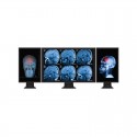 Multi Stream Transport Hub &ndash; Mini DisplayPort 1.2 to Triple Head DisplayPort MST Hub
