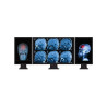 Multi Stream Transport Hub &ndash; Mini DisplayPort 1.2 to Triple Head DisplayPort MST Hub